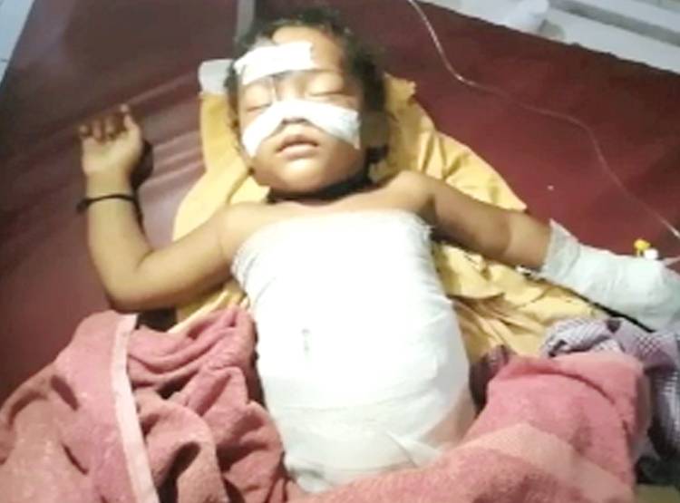 पेट काटकर मासूम बच्चे को फेंका, लीवर और आंत बाहर, क‍िस्मत से बची जान