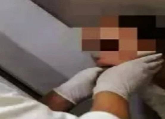 बहुत जोर से हंसी महिला तो उखड़ गया जबड़ा, खुला रह गया मुंह