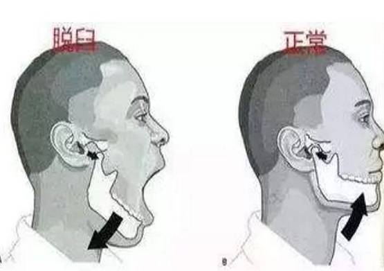 बहुत जोर से हंसी महिला तो उखड़ गया जबड़ा, खुला रह गया मुंह