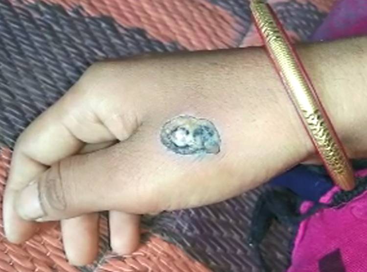 6 द‍िन व‍िवाह‍िता से रेप, पत‍ि के नाम को सिगरेट से दाग कर मिटाया