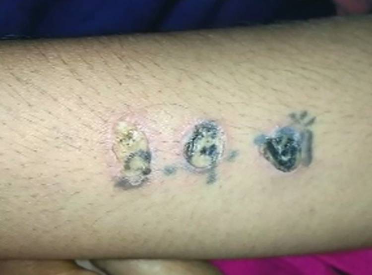 6 द‍िन व‍िवाह‍िता से रेप, पत‍ि के नाम को सिगरेट से दाग कर मिटाया