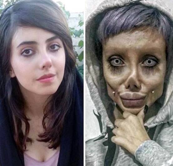 एंजेलिना जॉली बनने के चक्कर में सर्जरी से बर्बाद किया चेहरा, अरेस्ट