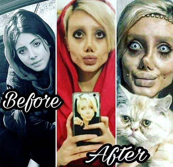 एंजेलिना जॉली बनने के चक्कर में सर्जरी से बर्बाद किया चेहरा, अरेस्ट