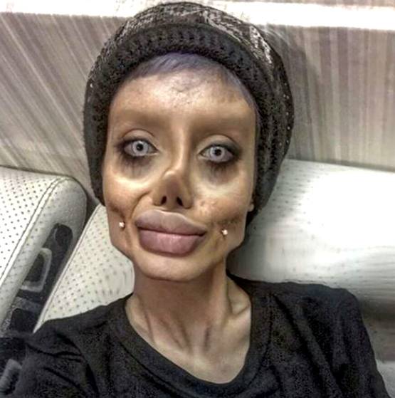 एंजेलिना जॉली बनने के चक्कर में सर्जरी से बर्बाद किया चेहरा, अरेस्ट