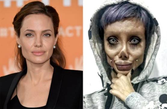 एंजेलिना जॉली बनने के चक्कर में सर्जरी से बर्बाद किया चेहरा, अरेस्ट