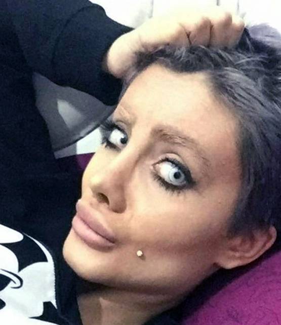 एंजेलिना जॉली बनने के चक्कर में सर्जरी से बर्बाद किया चेहरा, अरेस्ट