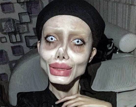 एंजेलिना जॉली बनने के चक्कर में सर्जरी से बर्बाद किया चेहरा, अरेस्ट