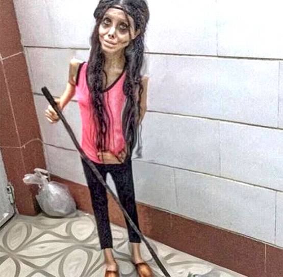 एंजेलिना जॉली बनने के चक्कर में सर्जरी से बर्बाद किया चेहरा, अरेस्ट