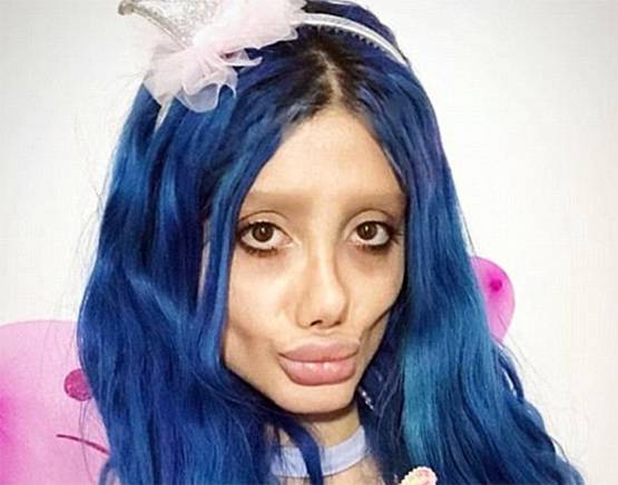 एंजेलिना जॉली बनने के चक्कर में सर्जरी से बर्बाद किया चेहरा, अरेस्ट