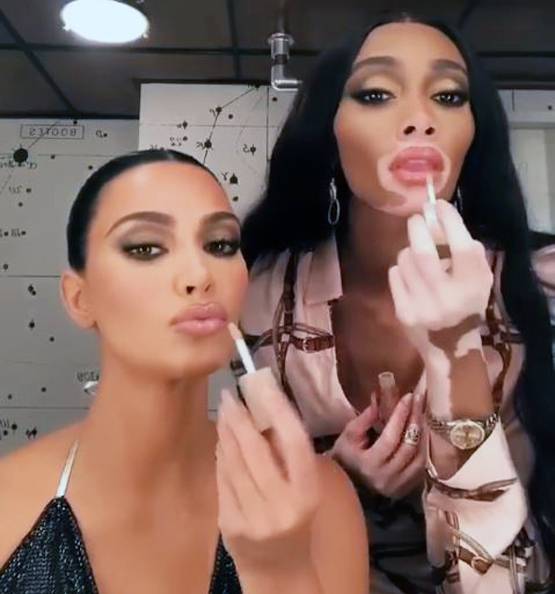 विनी हार्लो: चेहरे की वजह से बना मजाक, आज हैं ग्लोबल स्टार