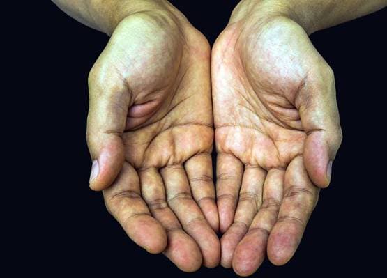 जानिए, आपके बारे में क्या बताता है आपकी हथेली का रंग?