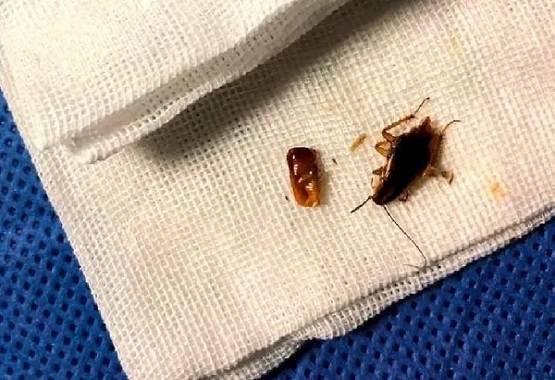 कान में हो रही थी खुजली, डॉक्टर ने देखा तो उड़े होश निकले 10 कॉकरोच