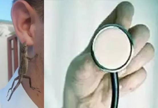 कान में हो रही थी खुजली, डॉक्टर ने देखा तो उड़े होश निकले 10 कॉकरोच