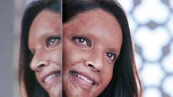 शॉकिंग है इन सितारों का ट्रांसफॉर्मेशन, किसी ने घटाया वजन, किसी ने बदला लुक