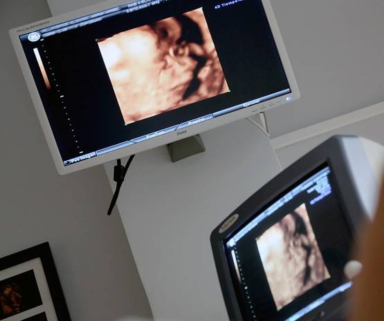 फर्टिलाइज्ड एग की हुई 'मौत' तो करना होगा अंतिम संस्कार, पेश हुआ बिल