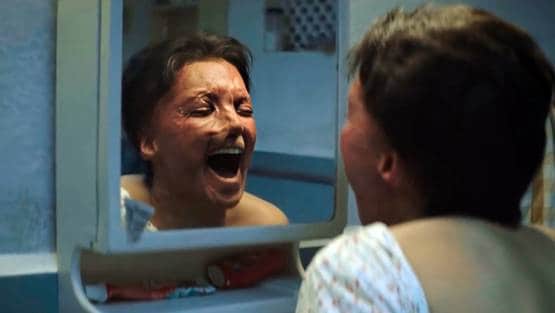 दीपिका का छपाक ट्रेलर जबरदस्त, तस्वीरें देख खड़े हो जाएंगे रोंगटे