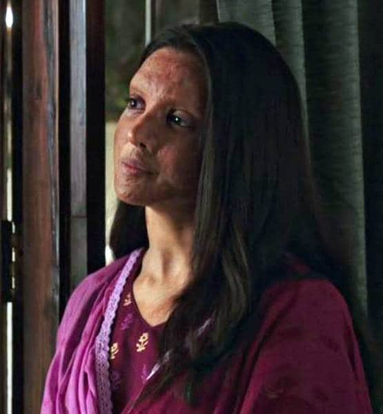 दीपिका का छपाक ट्रेलर जबरदस्त, तस्वीरें देख खड़े हो जाएंगे रोंगटे