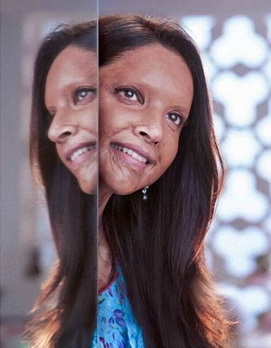 छपाक: कौन है वो लड़की जिसका दर्द-जज्बा, पर्दे पर दिखाने जा रही हैं दीपिका