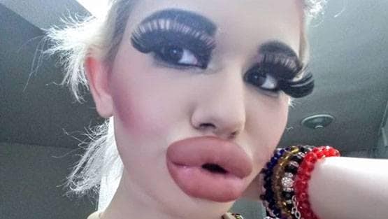 बार्बी डॉल बनने के लिए बर्बाद कर डाला चेहरा और फिर...