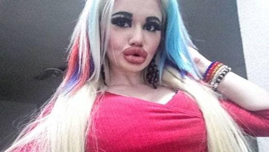 बार्बी डॉल बनने के लिए बर्बाद कर डाला चेहरा और फिर...