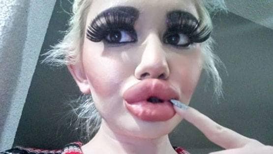 बार्बी डॉल बनने के लिए बर्बाद कर डाला चेहरा और फिर...