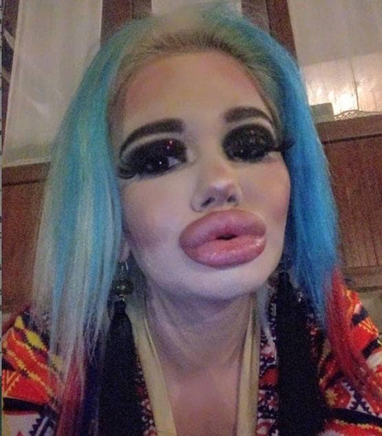 बार्बी डॉल बनने के लिए बर्बाद कर डाला चेहरा और फिर...