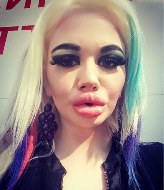 बार्बी डॉल बनने के लिए बर्बाद कर डाला चेहरा और फिर...