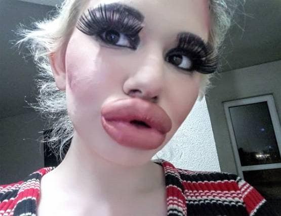 बार्बी डॉल बनने के लिए बर्बाद कर डाला चेहरा और फिर...