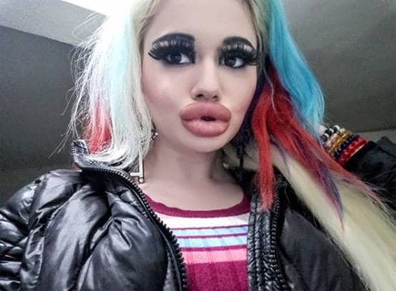 बार्बी डॉल बनने के लिए बर्बाद कर डाला चेहरा और फिर...