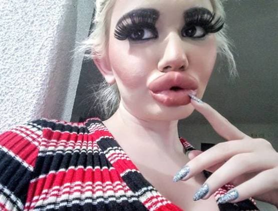 बार्बी डॉल बनने के लिए बर्बाद कर डाला चेहरा और फिर...