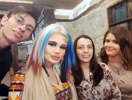 बार्बी डॉल बनने के लिए बर्बाद कर डाला चेहरा और फिर...