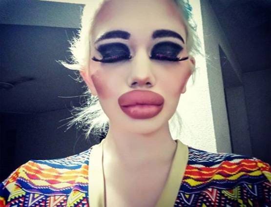 बार्बी डॉल बनने के लिए बर्बाद कर डाला चेहरा और फिर...