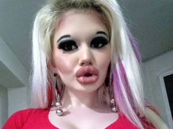 बार्बी डॉल बनने के लिए बर्बाद कर डाला चेहरा और फिर...