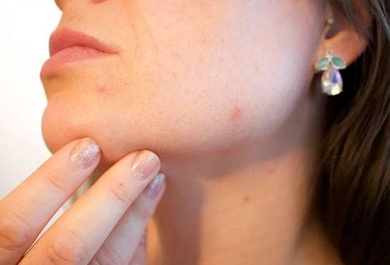 सर्दी में गर्म पानी से नहाना क्या हो सकता है नुकसानदायक?