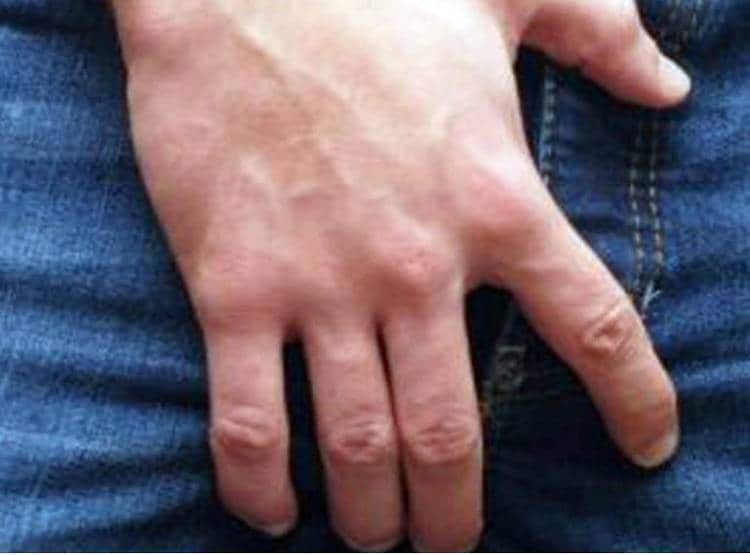 चोरी के आरोप में प्राइवेट पार्ट काट कर विक्षिप्त को जलाया, मौत