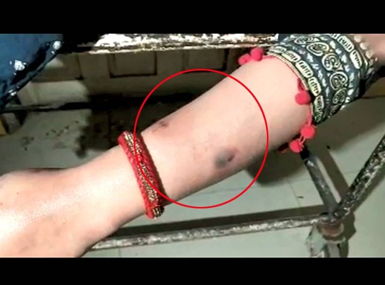 च‍िमटी से सांप को पकड़कर मृत पत्नी को कटवाया, शात‍िर पत‍ि की थी ये चाल