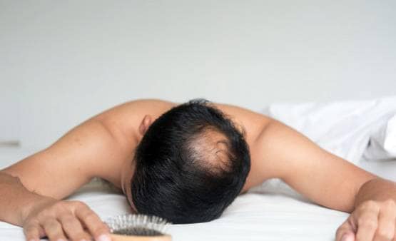 अगर इस तरह से झड़ रहे हैं बाल तो आप जल्द हो सकते हैं गंजे!