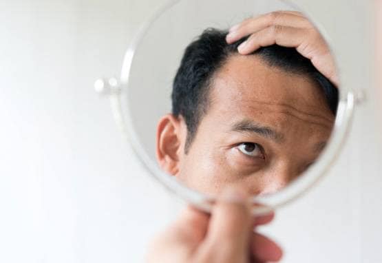 अगर इस तरह से झड़ रहे हैं बाल तो आप जल्द हो सकते हैं गंजे!