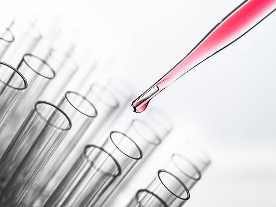 क्या है नोवेल कोरोना वायरस? जो बना रहस्यमयी मौतों की वजह