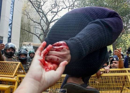 कौन हैं शादाब फारुक, जिसे जामिया में लगी गोली, ऐसी है कैंपस में इमेज