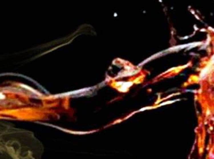 उन्नाव: लड़की ने फेंका लड़के पर तेजाब, एकतरफा प्यार में थी पागल