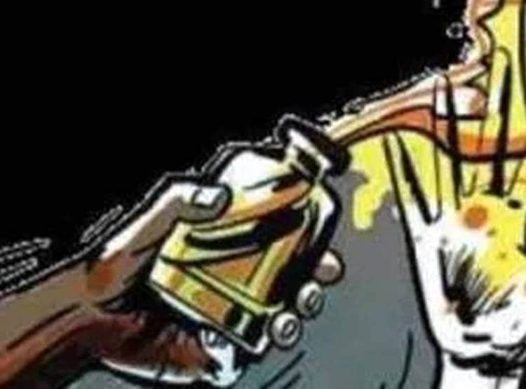 उन्नाव: लड़की ने फेंका लड़के पर तेजाब, एकतरफा प्यार में थी पागल