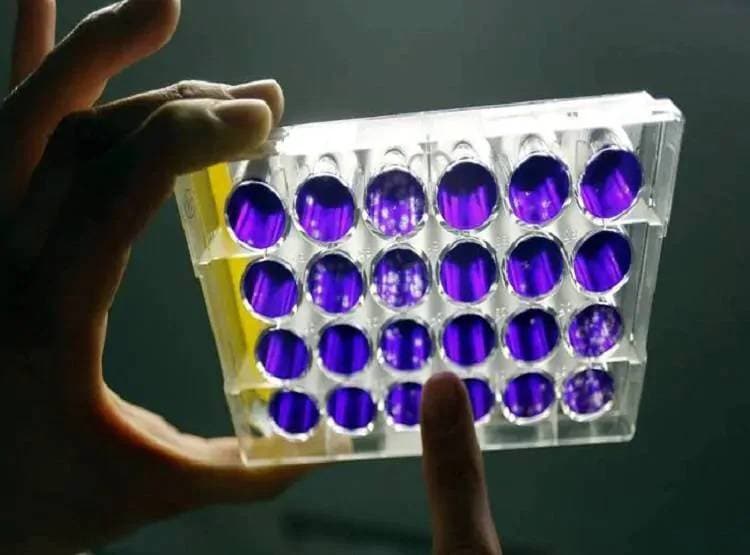 चमगादड़ खाकर लड़की ने दुनिया में फैलाया कोरोना वायरस? क्या है सच्चाई..