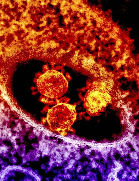 क्या है Coronavirus? सऊदी के बाद चीन में हाहाकार, जानिए कितना खतरनाक