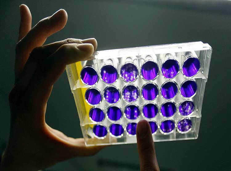 क्या है Coronavirus? सऊदी के बाद चीन में हाहाकार, जानिए कितना खतरनाक