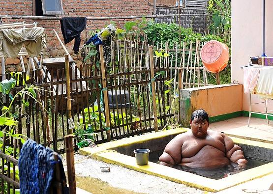 दुबला हो गया दुनिया का सबसे मोटा बच्चा, अपनाई ये तरकीब