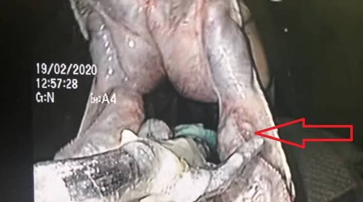 सांप ने निगल लिया बड़ा तौलिया तो डॉक्टरों ने ऐसे बचाई जान