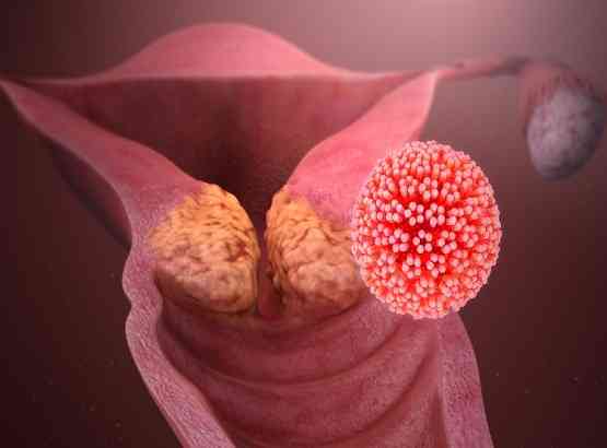 पुरुषों को इन 5 कैंसरों का सबसे ज्यादा खतरा, जान लें लक्षण