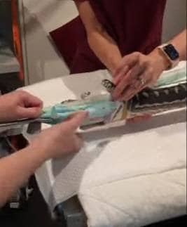 सांप ने निगल लिया बड़ा तौलिया तो डॉक्टरों ने ऐसे बचाई जान