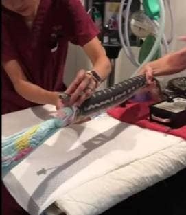 सांप ने निगल लिया बड़ा तौलिया तो डॉक्टरों ने ऐसे बचाई जान